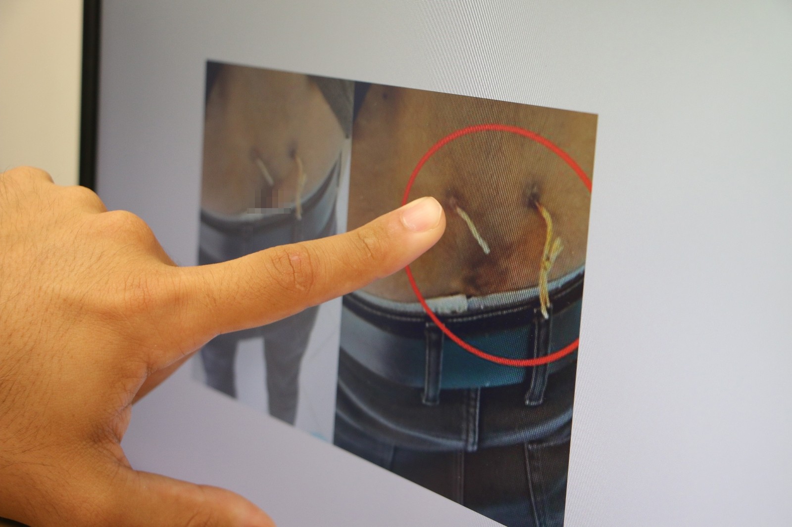 Ağrıları geçsin diye...